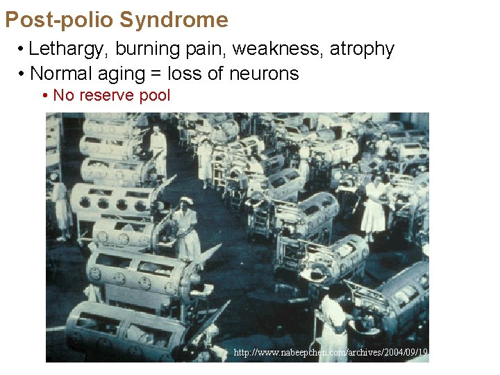 Post-polio Syndrome • Lethargy, burning pain, weakness, atrophy • Normal aging = loss of