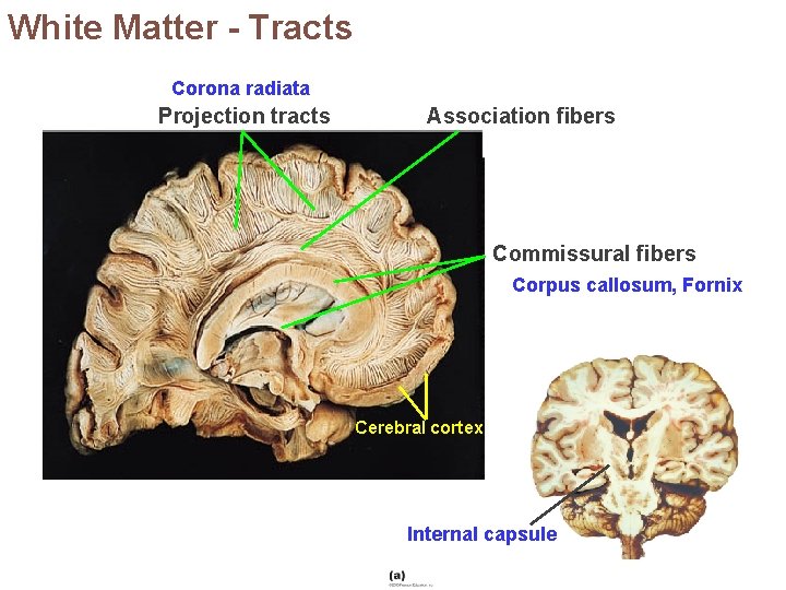 White Matter - Tracts Corona radiata Projection tracts Association fibers Anterior Commissural fibers Corpus