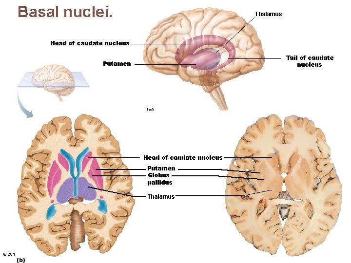 Basal nuclei. Thalamus Head of caudate nucleus Tail of caudate nucleus Putamen Anterior Head