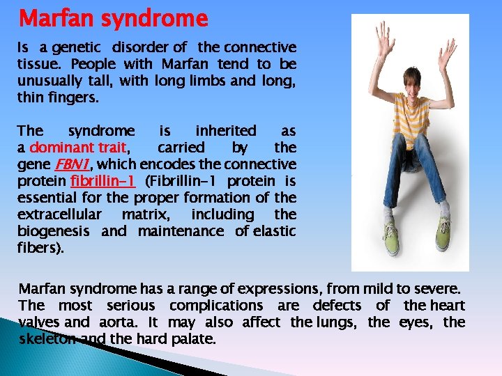 Marfan syndrome Is a genetic disorder of the connective tissue. People with Marfan tend