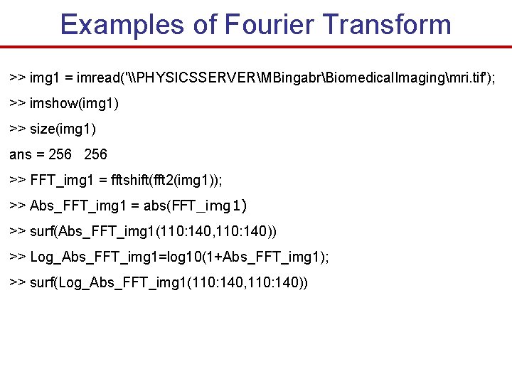 Examples of Fourier Transform >> img 1 = imread('\PHYSICSSERVERMBingabrBiomedical. Imagingmri. tif'); >> imshow(img 1)