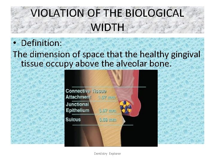 VIOLATION OF THE BIOLOGICAL WIDTH • Definition: The dimension of space that the healthy
