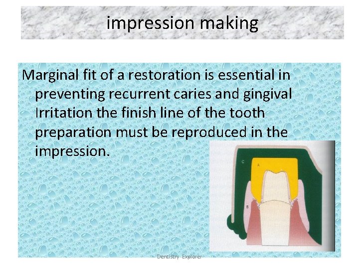 impression making Marginal fit of a restoration is essential in preventing recurrent caries and