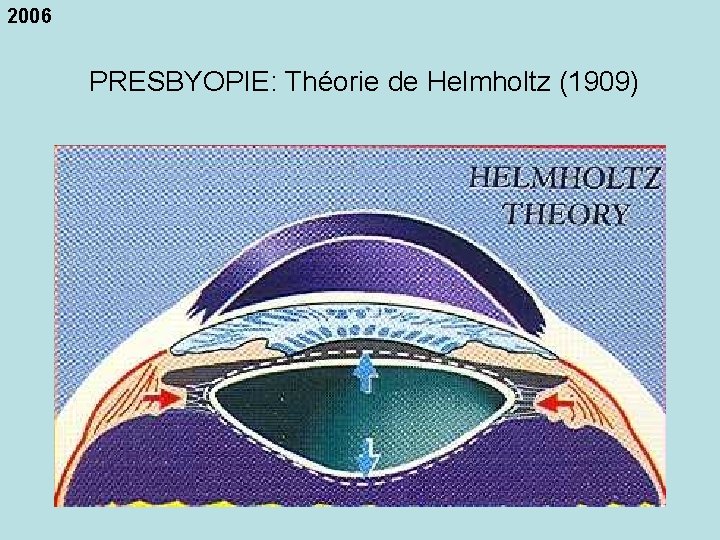 2006 PRESBYOPIE: Théorie de Helmholtz (1909) 
