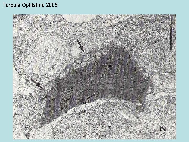 Turquie Ophtalmo 2005 