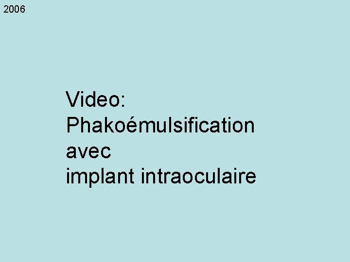 2006 Video: Phakoémulsification avec implant intraoculaire 