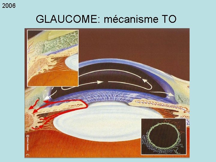 2006 GLAUCOME: mécanisme TO 