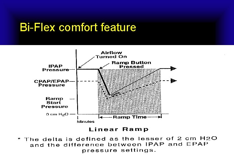 Bi-Flex comfort feature  Bi-Flex comfort feature