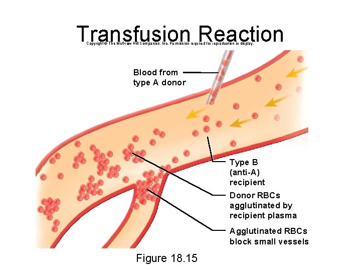 Transfusion Reaction Copyright © The Mc. Graw-Hill Companies, Inc. Permission required for reproduction or