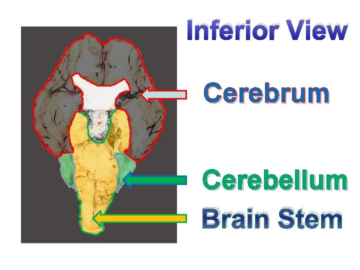 Inferior View Cerebrum Cerebellum Brain Stem 