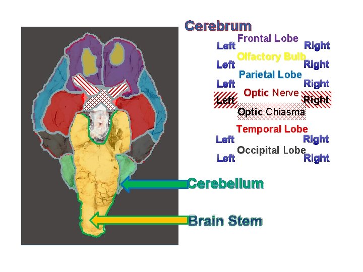 Cerebrum Frontal Lobe Right Olfactory Bulb Right Left Parietal Lobe Right Left Optic Nerve