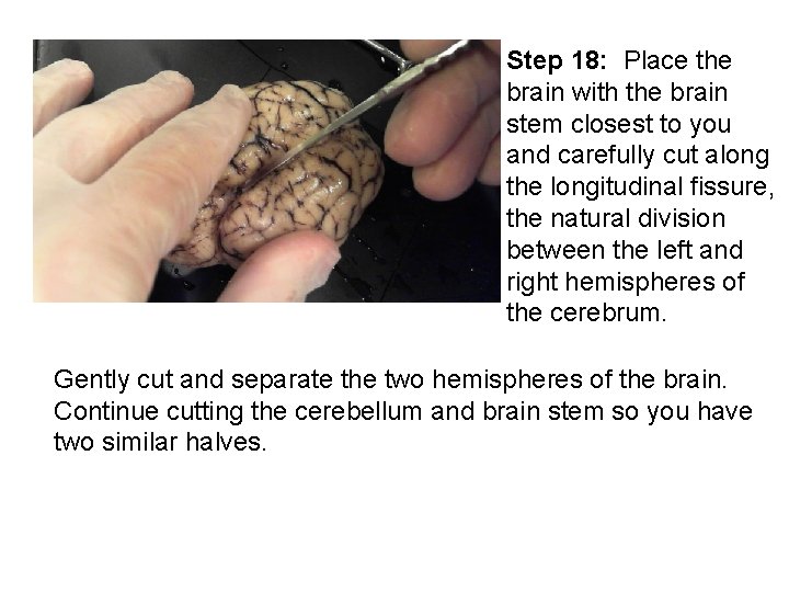Step 18: Place the brain with the brain stem closest to you and carefully