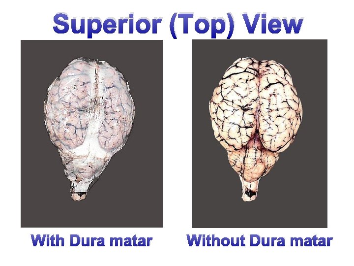 Superior (Top) View With Dura matar Without Dura matar 