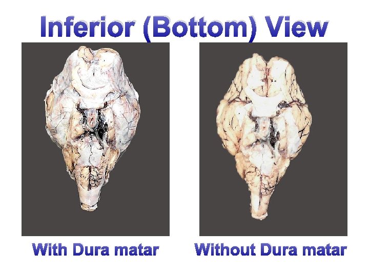 Inferior (Bottom) View With Dura matar Without Dura matar 