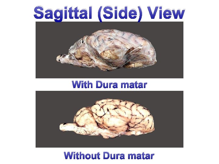 Sagittal (Side) View With Dura matar Without Dura matar 