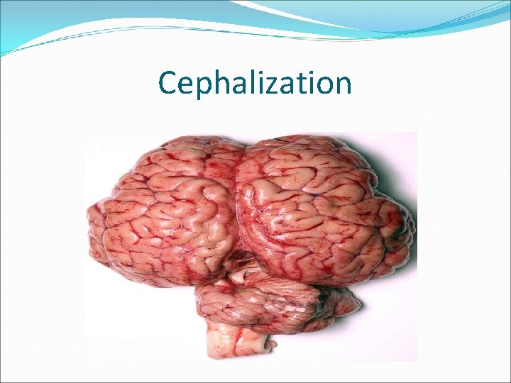 Cephalization 