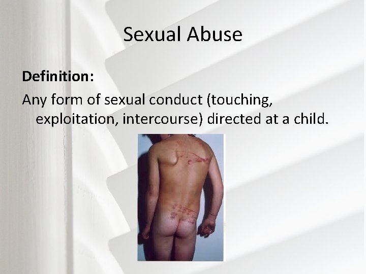 Sexual Abuse Definition: Any form of sexual conduct (touching, exploitation, intercourse) directed at a