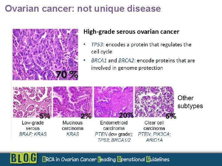 Ovarian cancer: not unique disease 