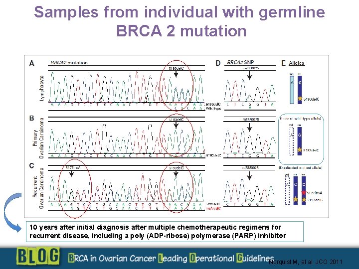 Samples from individual with germline BRCA 2 mutation 10 years after initial diagnosis after