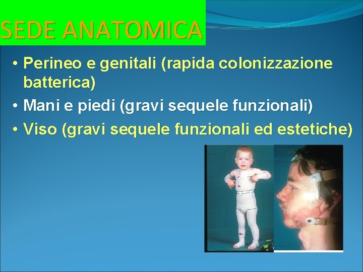 SEDE ANATOMICA • Perineo e genitali (rapida colonizzazione batterica) • Mani e piedi (gravi