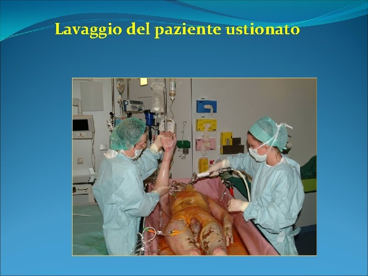 Lavaggio del paziente ustionato 