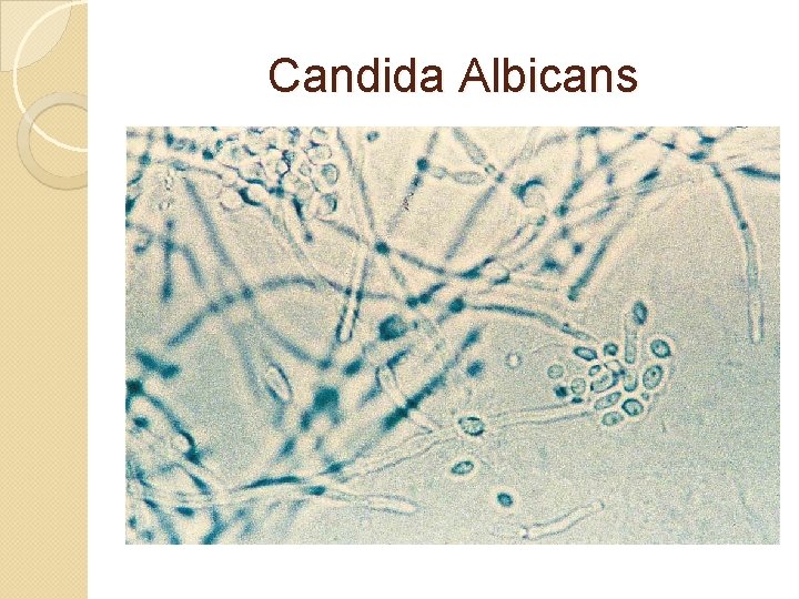 Candida Albicans 