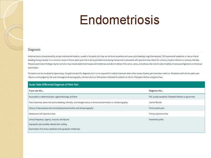 Endometriosis 