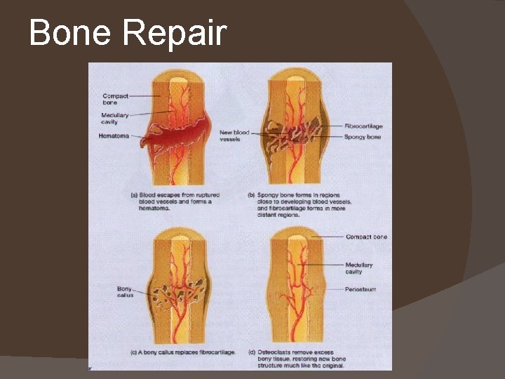 Bone Repair 