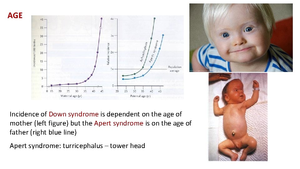 AGE Incidence of Down syndrome is dependent on the age of mother (left figure)