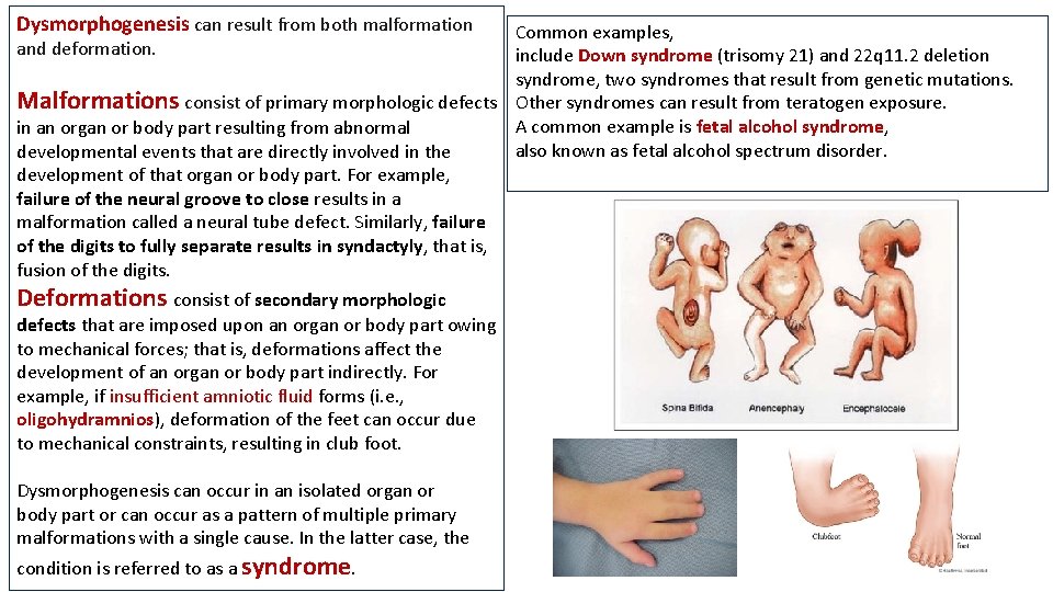 Dysmorphogenesis can result from both malformation Common examples, and deformation. include Down syndrome (trisomy