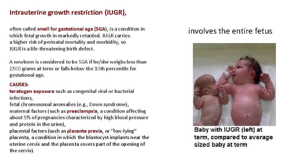 Intrauterine growth restriction (IUGR), often called small for gestational age (SGA), is a condition