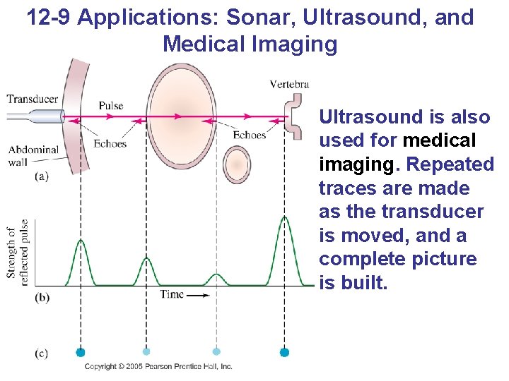 12 -9 Applications: Sonar, Ultrasound, and Medical Imaging Ultrasound is also used for medical