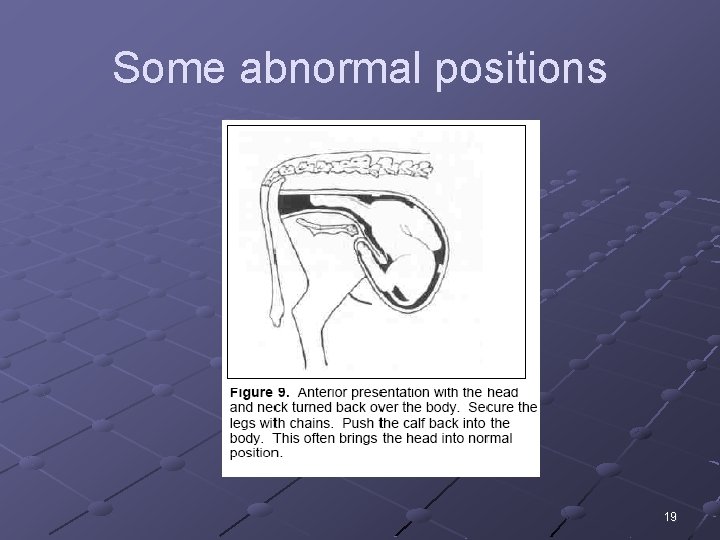 Some abnormal positions 19 