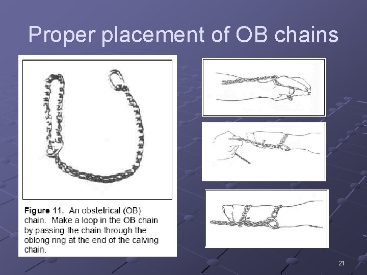 Proper placement of OB chains 21 