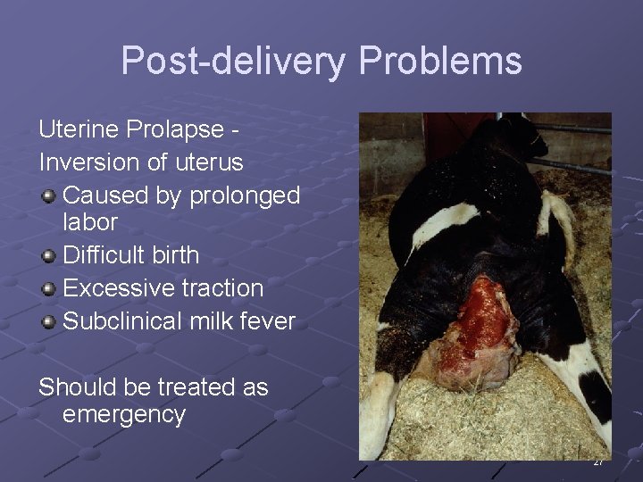 Post-delivery Problems Uterine Prolapse Inversion of uterus Caused by prolonged labor Difficult birth Excessive