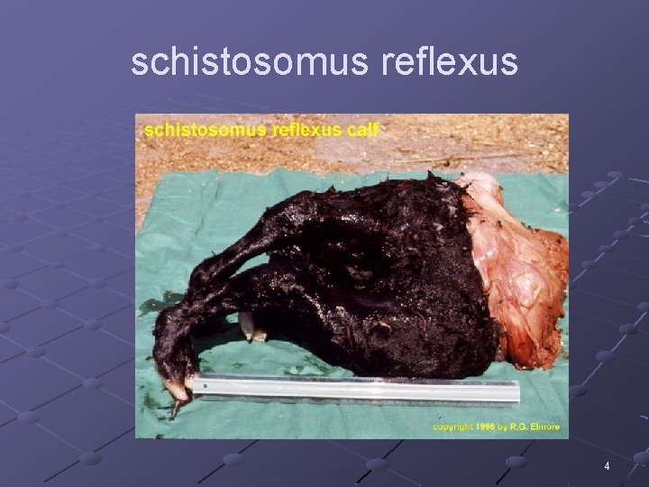 schistosomus reflexus 4 