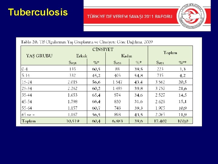 Tuberculosis 