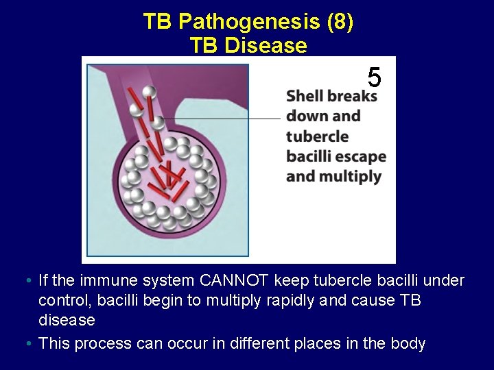 TB Pathogenesis (8) TB Disease 5 • If the immune system CANNOT keep tubercle