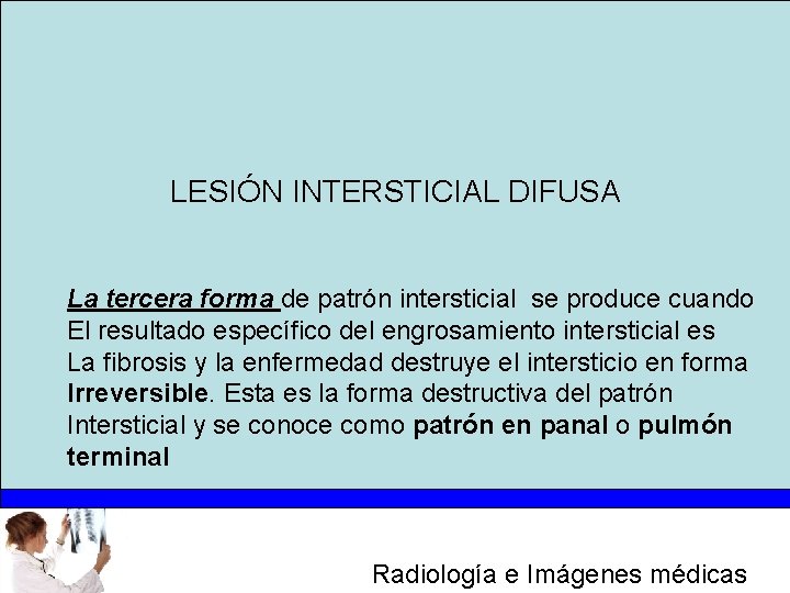 LESIÓN INTERSTICIAL DIFUSA La tercera forma de patrón intersticial se produce cuando El resultado