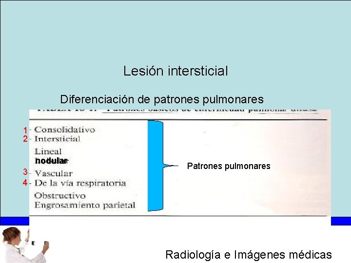 Lesión intersticial Diferenciación de patrones pulmonares 1 2 nodular 3 4 Patrones pulmonares Radiología