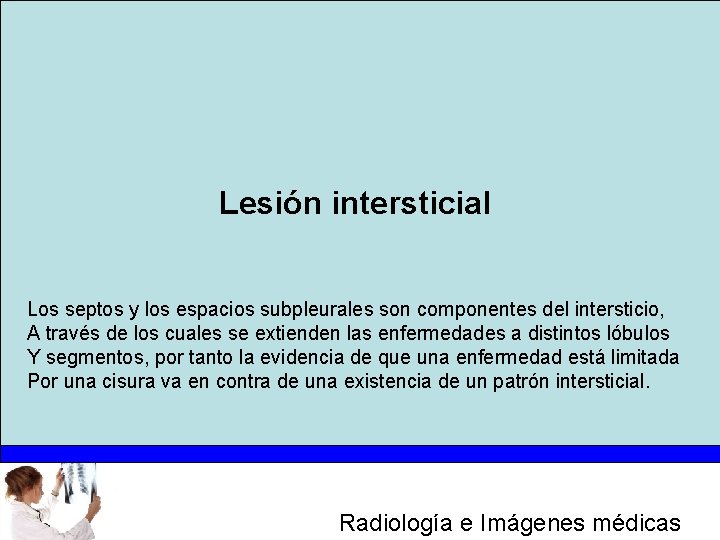 Lesión intersticial Los septos y los espacios subpleurales son componentes del intersticio, A través