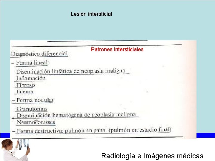 Lesión intersticial Patrones intersticiales Radiología e Imágenes médicas 