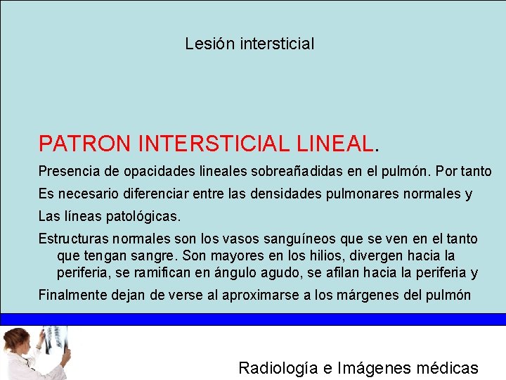Lesión intersticial PATRON INTERSTICIAL LINEAL. Presencia de opacidades lineales sobreañadidas en el pulmón. Por