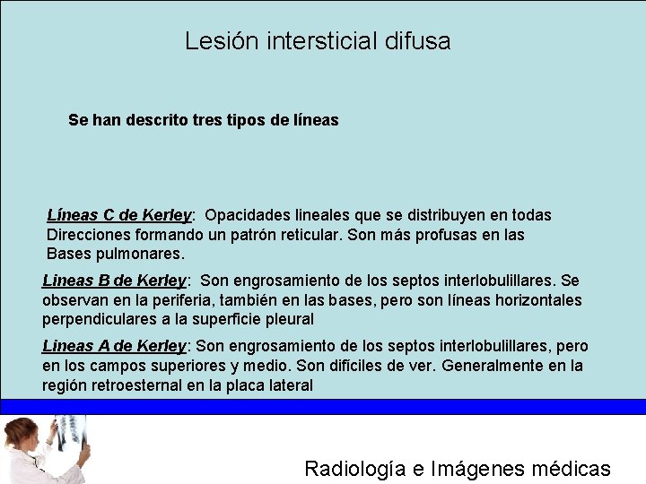 Lesión intersticial difusa Se han descrito tres tipos de líneas Líneas C de Kerley: