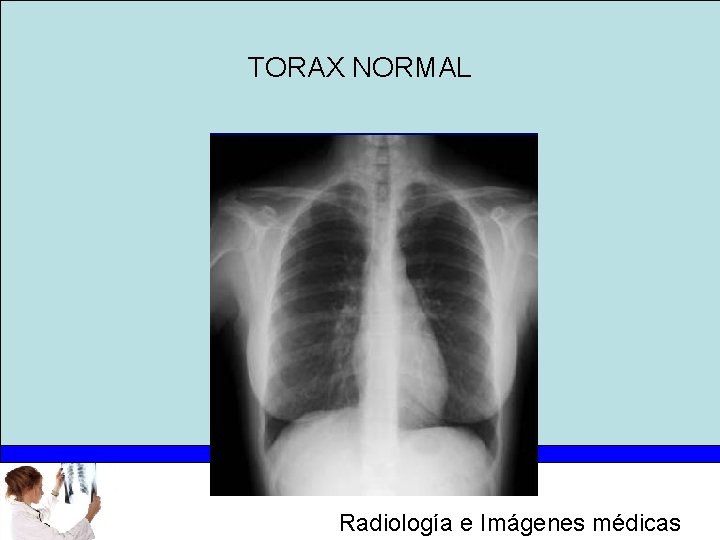 TORAX NORMAL Radiología e Imágenes médicas 