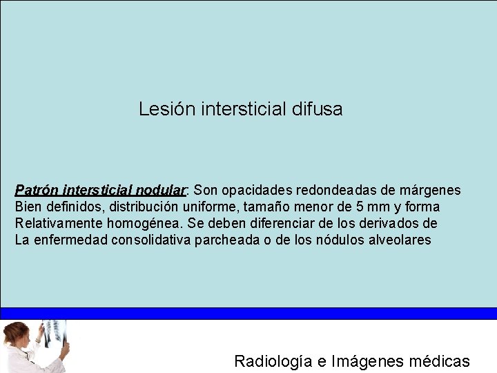 Lesión intersticial difusa Patrón intersticial nodular: Son opacidades redondeadas de márgenes Bien definidos, distribución