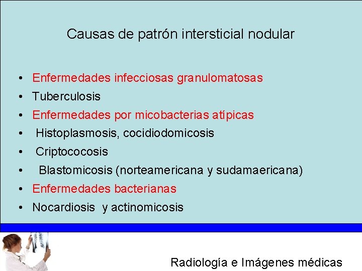 Causas de patrón intersticial nodular • Enfermedades infecciosas granulomatosas • Tuberculosis • Enfermedades por