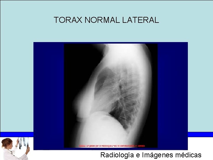 TORAX NORMAL LATERAL Radiología e Imágenes médicas 