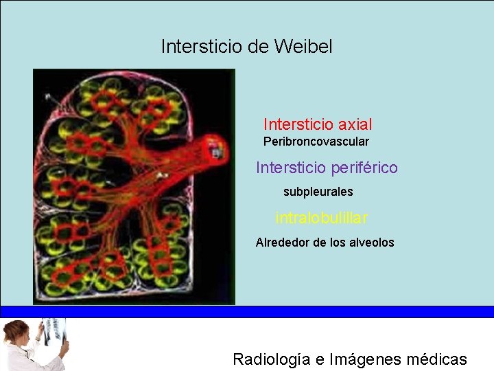 Intersticio de Weibel Intersticio axial Peribroncovascular Intersticio periférico subpleurales intralobulillar Alrededor de los alveolos