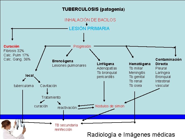 TUBERCULOSIS (patogenia) INHALACIÓN DE BACILOS LESIÓN PRIMARIA Curación Fibrosis 32% Calc. Pulm 17% Calc.